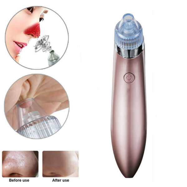 ⁦Electric Blackhead Vacuum Pore Cleaner Acne Pimple Remover Strong Suction Tool Electric Blackhead Remover Pore Vacuum Suction Diamond Dermabrasion Face Cleaner⁩ - الصورة ⁦9⁩