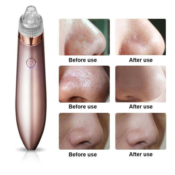 ⁦Electric Blackhead Vacuum Pore Cleaner Acne Pimple Remover Strong Suction Tool Electric Blackhead Remover Pore Vacuum Suction Diamond Dermabrasion Face Cleaner⁩ - الصورة ⁦4⁩